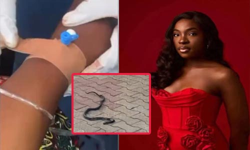 Hospital Denies Negligence Following Death of Singer Ifunanya Nwagene from Snake Bite
