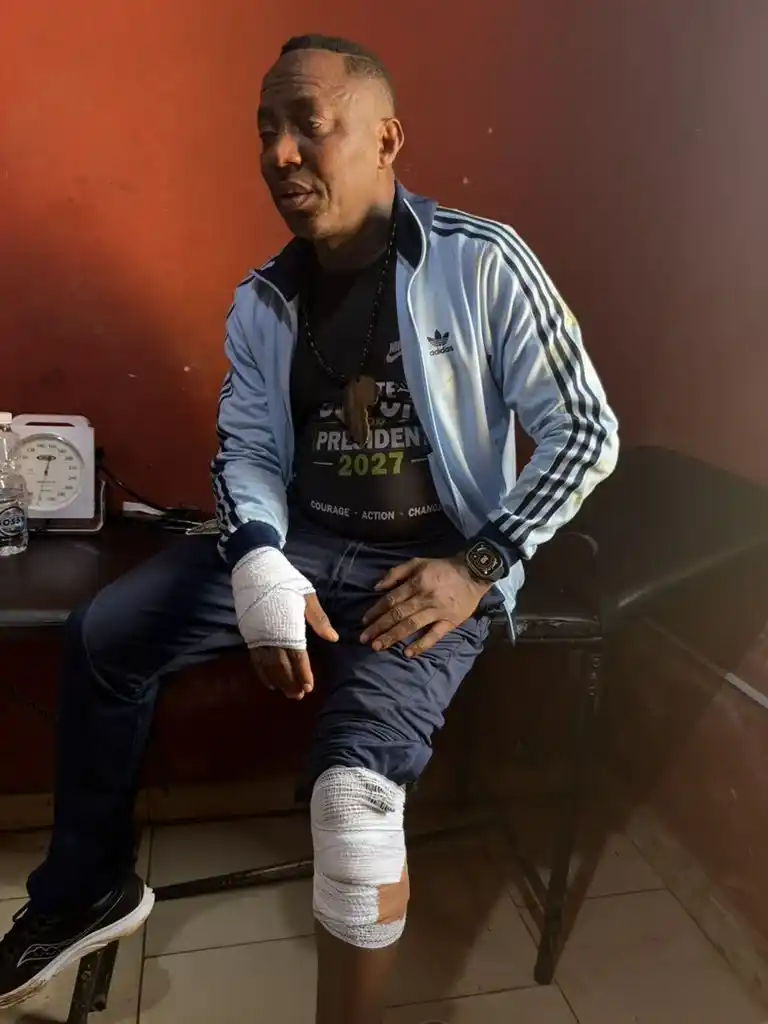 Sowore Responds To Ado-Ekiti Incident, Alleges Attack By Armed Men, Set Aside Police Account